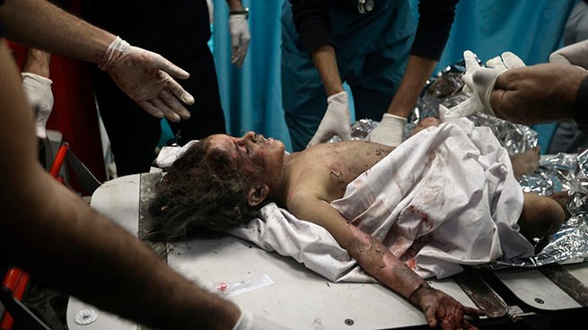Израильские обстрелы несколько раз обрушивались на больницы в секторе Газа, обвиняя ХАМАС в использовании их «в террористических целях». AP Photo/Мохаммед Дахман