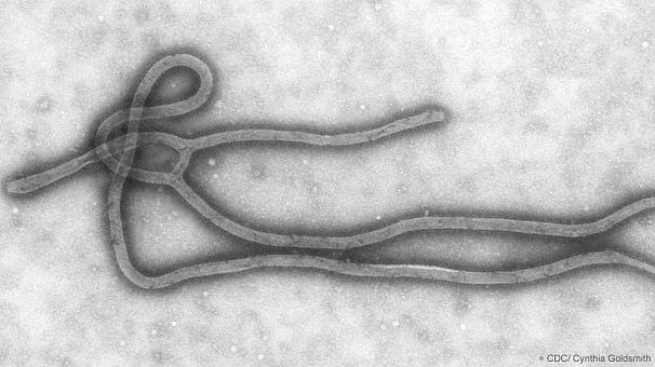 Что важно знать про вирус Эбола