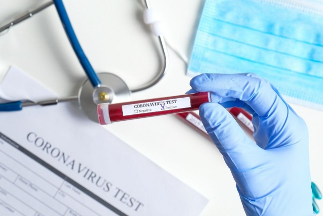 Число инфицированных коронавирусом в Греции достигло 7 человек