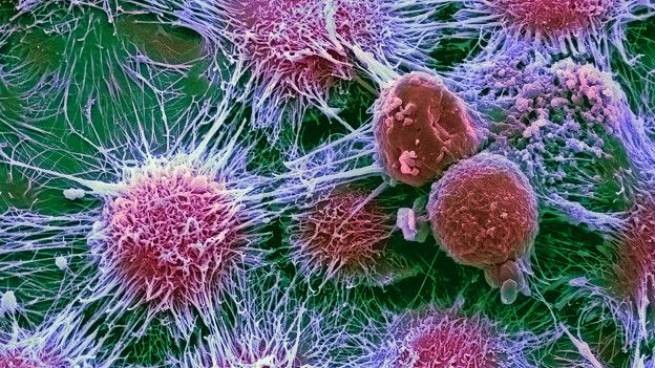 Новые исследования Rutgers в области онкологии: раковые клетки-зомби