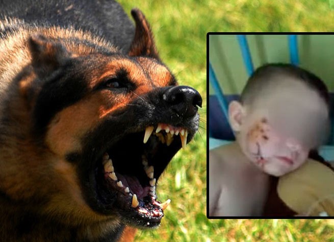 16 швов: На 4-х летнего мальчика напала собака