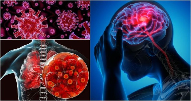 «Тихий убийца»-коронавирус: новый побочный эффект «запускает» воспаление в мозгу