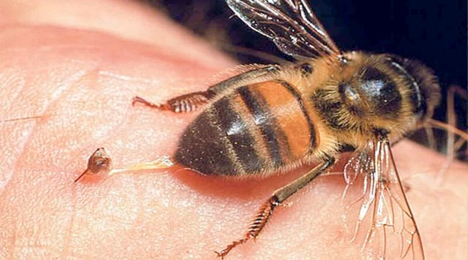 Смерть от укуса пчелы