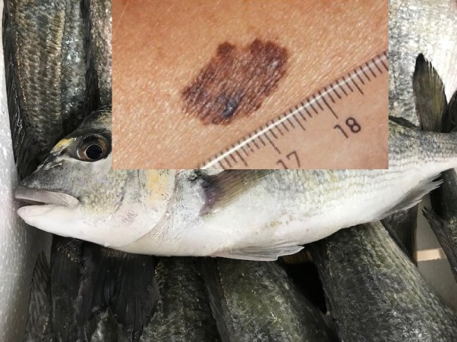 Исследование: повышенный риск развития меланомы у тех, кто ест большое количество рыбы