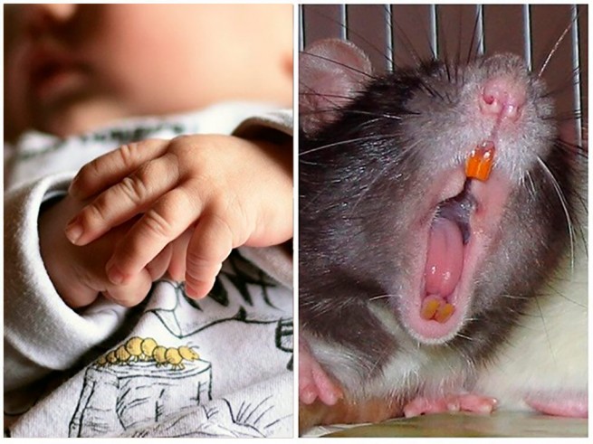 Младенца, покусанного крысами, госпитализировали