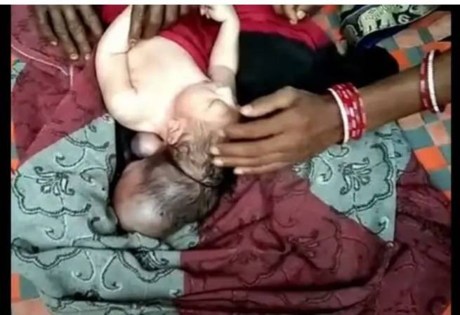Индия: новорожденный с тремя головами привлек толпы паломников