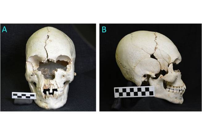 Уникальная находка: «проказный» череп обнаружили на острове в Карибском море