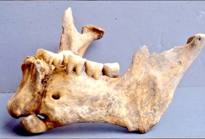 В Греции обнаружен череп византийского воина с золотой проволокой на челюсти