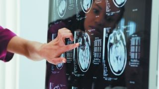 Исследование: проблемы, которые Covid-19 может вызвать в головном мозге