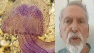 Укус фиолетовой медузы, шокирующие свидетельства пловца